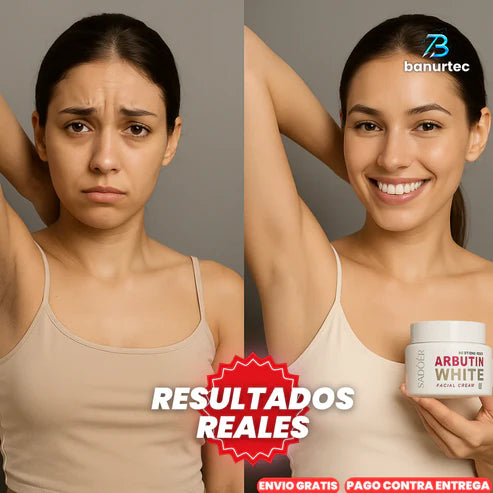 Crema Aclarante Arbutin